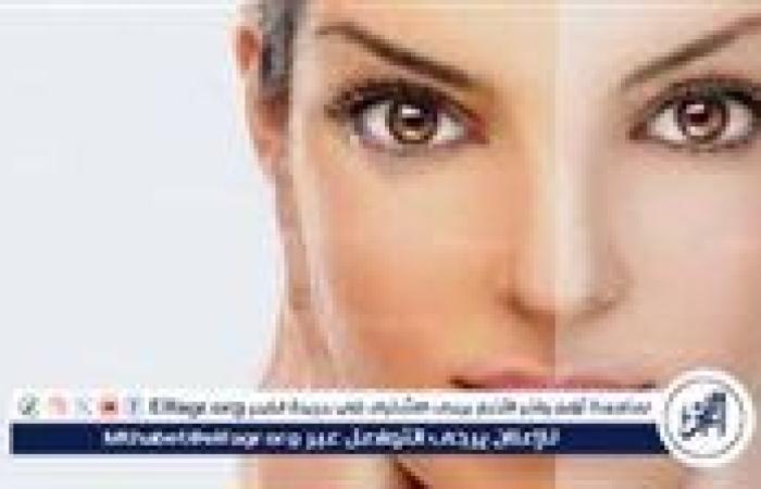 العسل والفراولة.. وصفات طبيعية لتفتيح البشرة